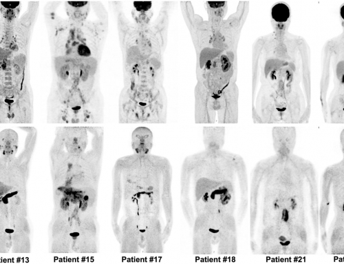 Fibroblast Activation Protein-Targeted PET/CT with 68 Ga-FAPI for Imaging IgG4-Related Disease: Comparison to 18 F-FDG PET/CT