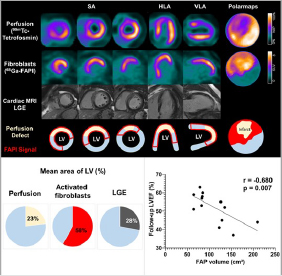 Abstract 413. “Predicting Remodeling and Outcome from Molecular Imaging of Fibroblast Activation in Patients after Acute Myocardial Infarction