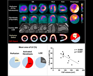 Current Status of Clinical Trials on FAP Targeted Radiopharmaceuticals
