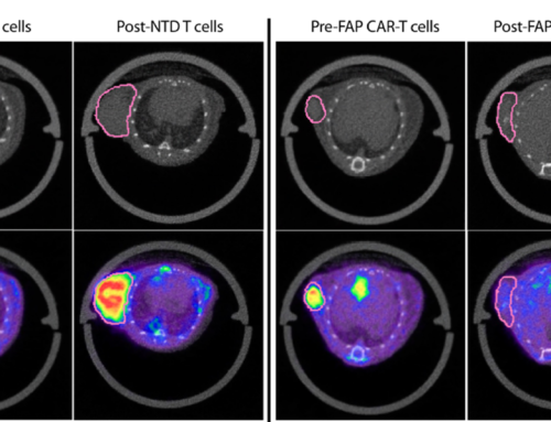 Monitoring Therapeutic Response to Anti-Fibroblast Activation Protein (FAP) CAR T Cells using [18F]AlF-FAPI-74