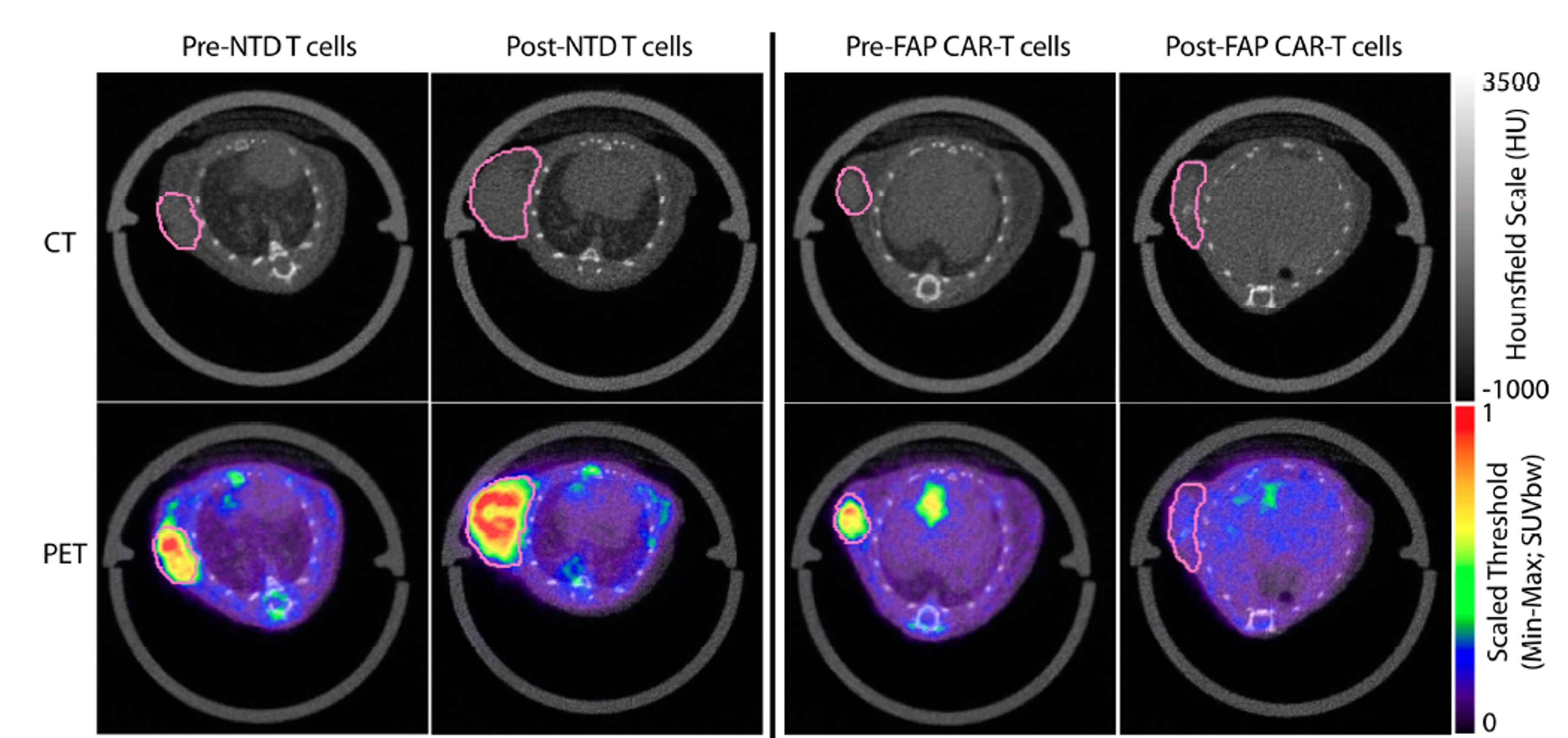 Monitoring Therapeutic Response to Anti-Fibroblast Activation Protein (FAP) CAR T Cells using [18F]AlF-FAPI-74