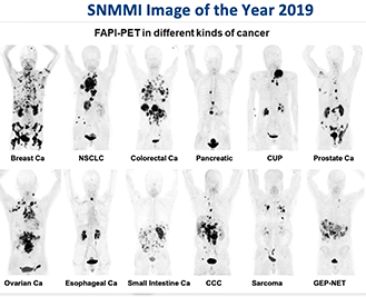 FAPI Clinical Development Updates