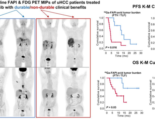 Comparison of Baseline 68Ga-FAPI and 18F-FDG PET/CT for Prediction of Response and Clinical Outcome in Patients with Unresectable Hepatocellular Carcinoma Treated with PD-1 Inhibitor and Lenvatinib