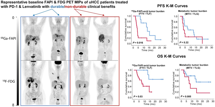 Comparison of Baseline 68Ga-FAPI and 18F-FDG PET/CT for Prediction of Response and Clinical Outcome in Patients with Unresectable Hepatocellular Carcinoma Treated with PD-1 Inhibitor and Lenvatinib