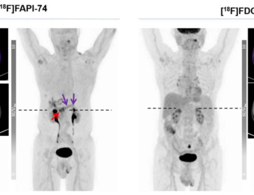 Head-to-Head Intra-Individual Comparison of Biodistribution and Tumor Uptake of [18F]FAPI-74 with [18F]FDG in Patients with PDAC: A Prospective Exploratory Study