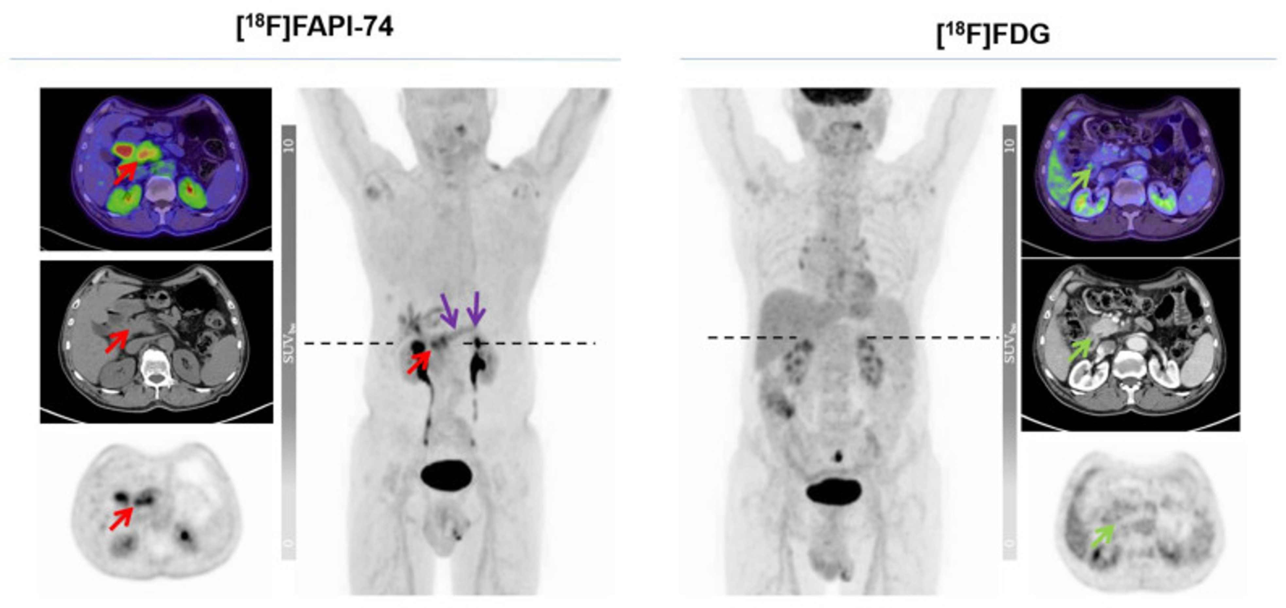 Head-to-Head Intra-Individual Comparison of FAP