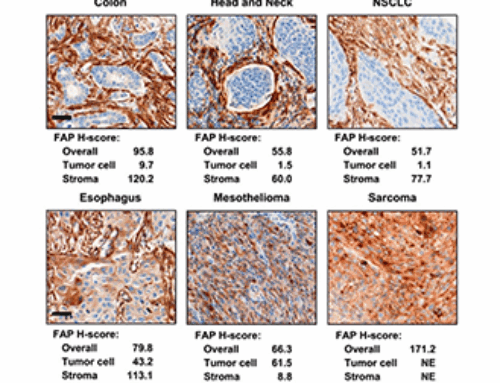 Current State of FAP Targeting Radioligands