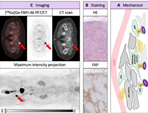 [68Ga]Ga-FAPI-46 PET/CT for penile cancer – a feasibility study