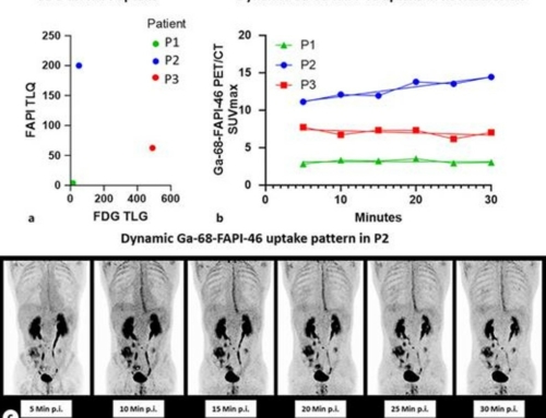 Discrimination between Inflammatory and Fibrotic Activity in Crohn’s Disease-Associated Ileal-Colonic Anastomotic Strictures by Combined Ga-68-FAPI-46 and F-18-FDG-PET/CT Imaging