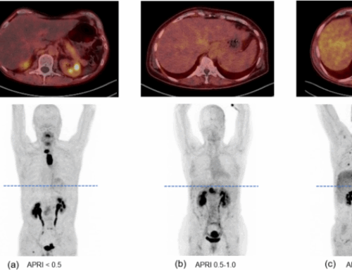 Efficacy of [68Ga]Ga-FAPI-PET as a non-invasive evaluation method of liver fibrosis