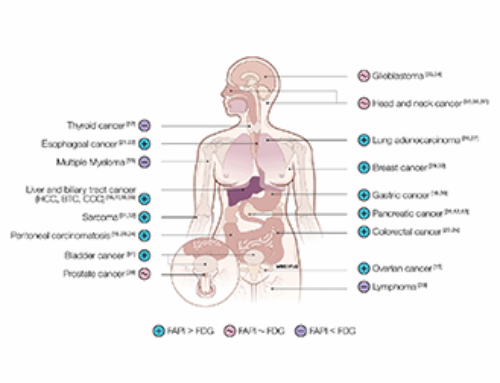 Current State of FAP Targeting Radioligands