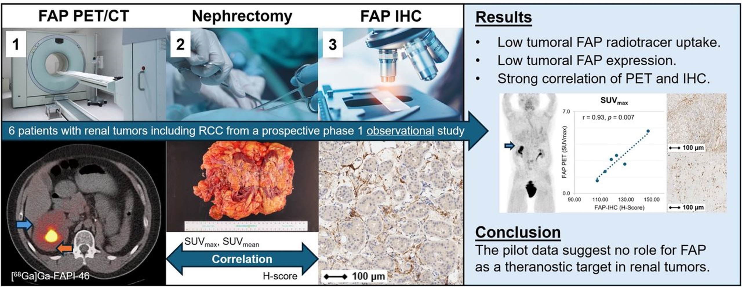 FAP Expression in Renal Tumors Assessed by [68Ga]Ga-FAPI-46 PET Imaging and FAP Immunohistochemistry: A Case Series of Six Patients from the Prospective Exploratory Trial NCT04147494