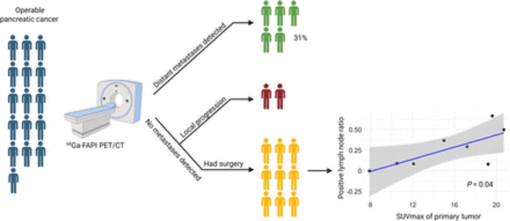 68Ga-FAPI PET/CT Prevents Futile Surgery and Demonstrates Tumor Biology in Patients with Pancreatic Ductal Adenocarcinoma