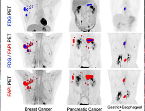 Addressing Unmet Needs with [18F]FAPI-74